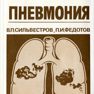 Пневмония